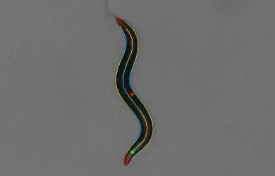 Worm phenotypes identified