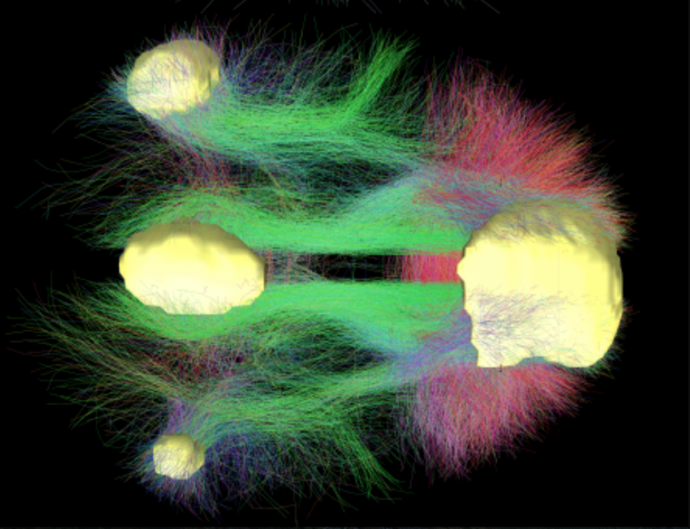 New research sheds light on the mechanisms of consciousness in the human brain