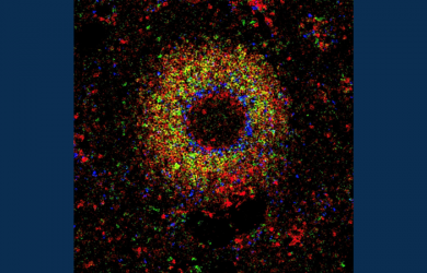 Previously undetected population complexity found in human lymphoid tissue B cells