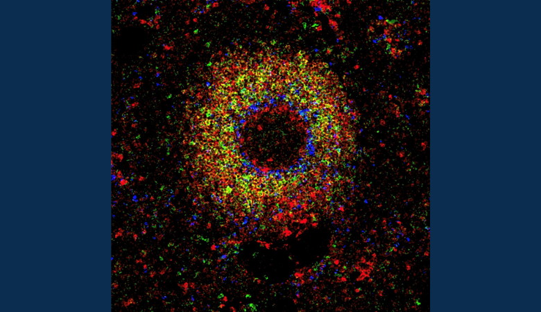 Previously undetected population complexity found in human lymphoid tissue B cells